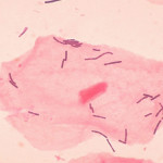 вагинальная микрофлора